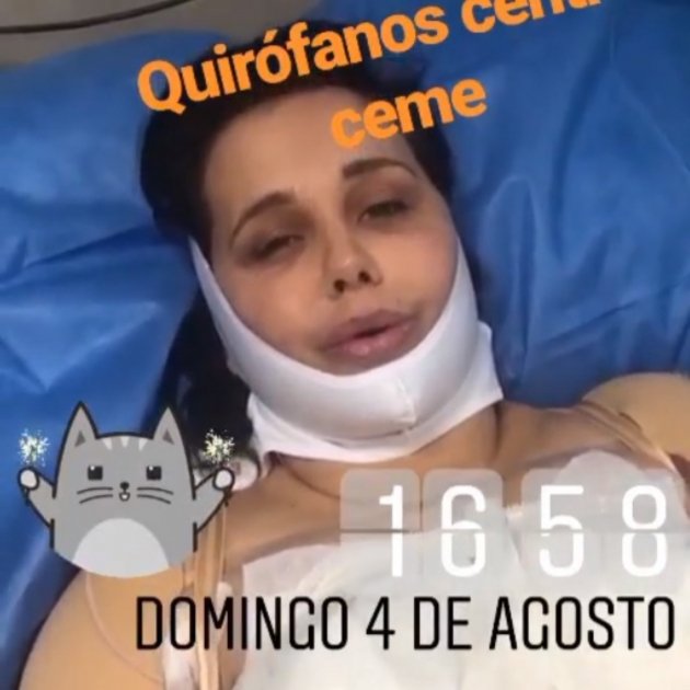 miriam sanchez operada instagram