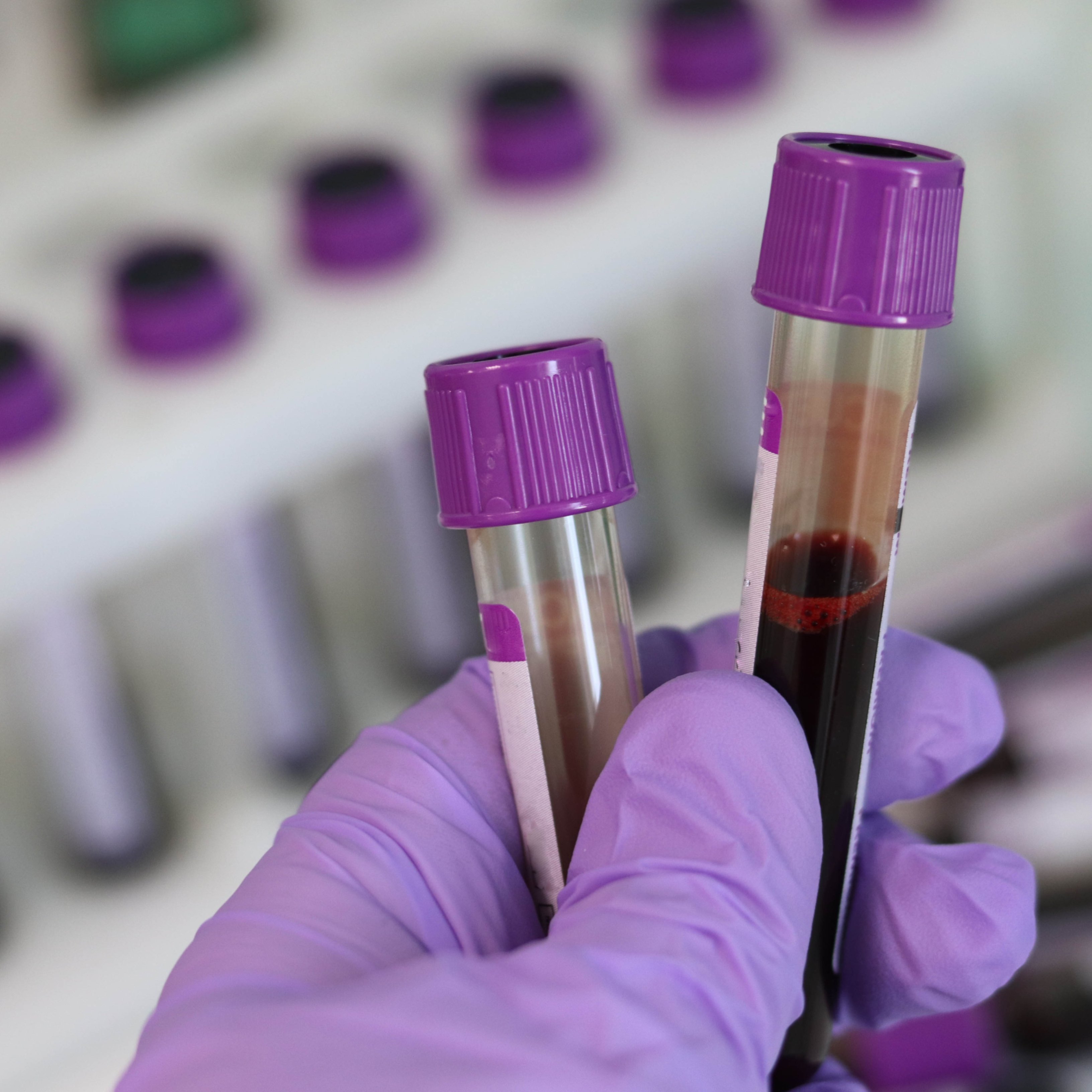 Una anàlisi de sang podrà predir l'esperança de vida de les persones