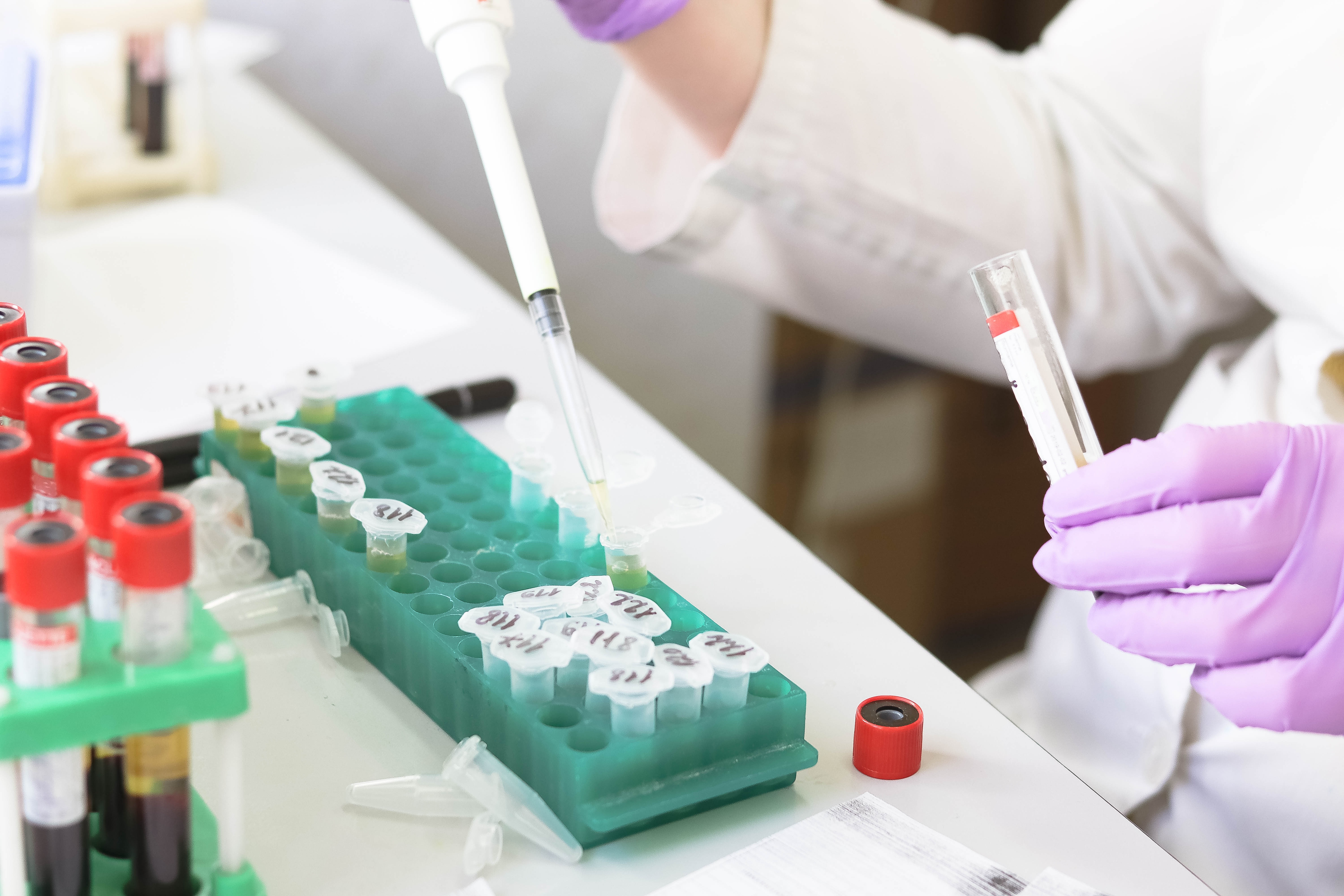 Sant Joan de Déu investiga per què els nens estan més protegits del coronavirus