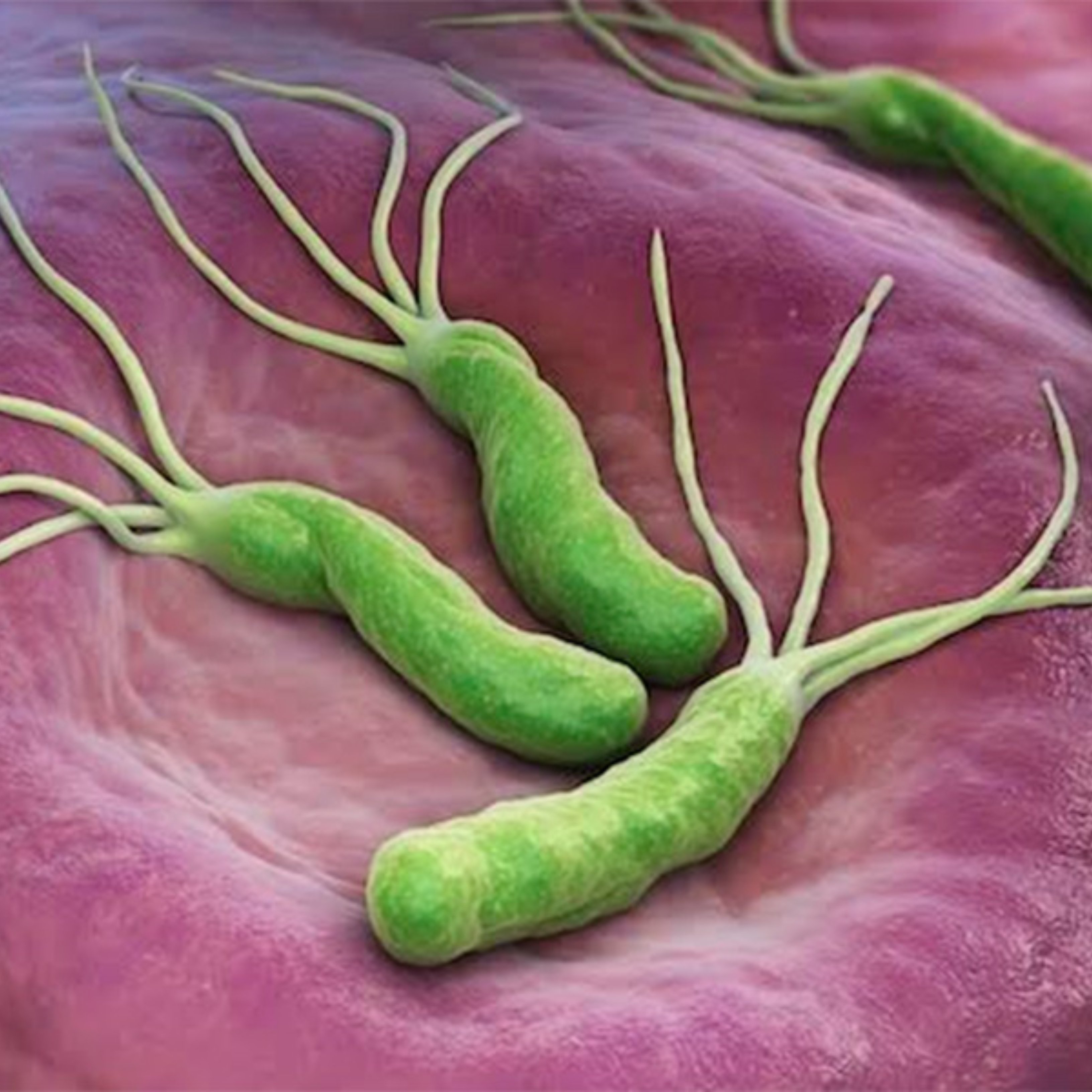 La consecuencias de tener el Helicobacter pylori, la infección más común del mundo