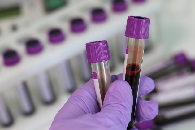 Muestras sangre