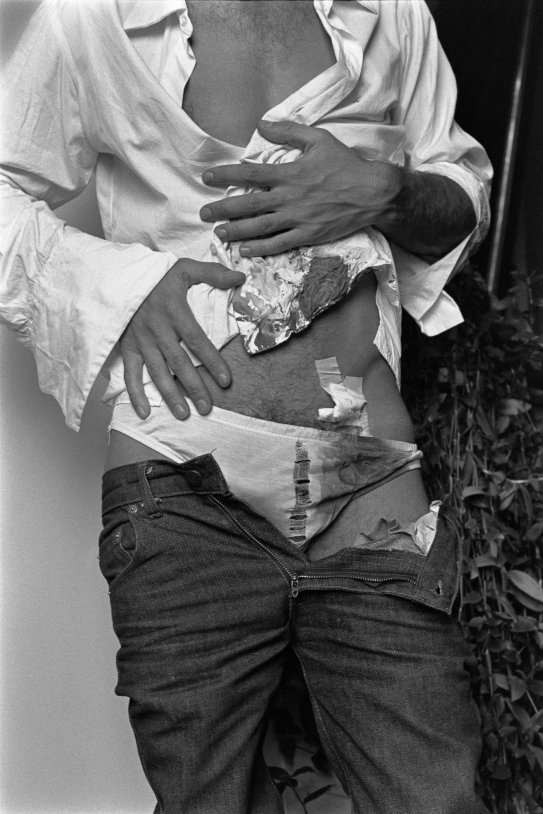 Alberto García Alix, Autorretrato cono el cuerpo herido 1981