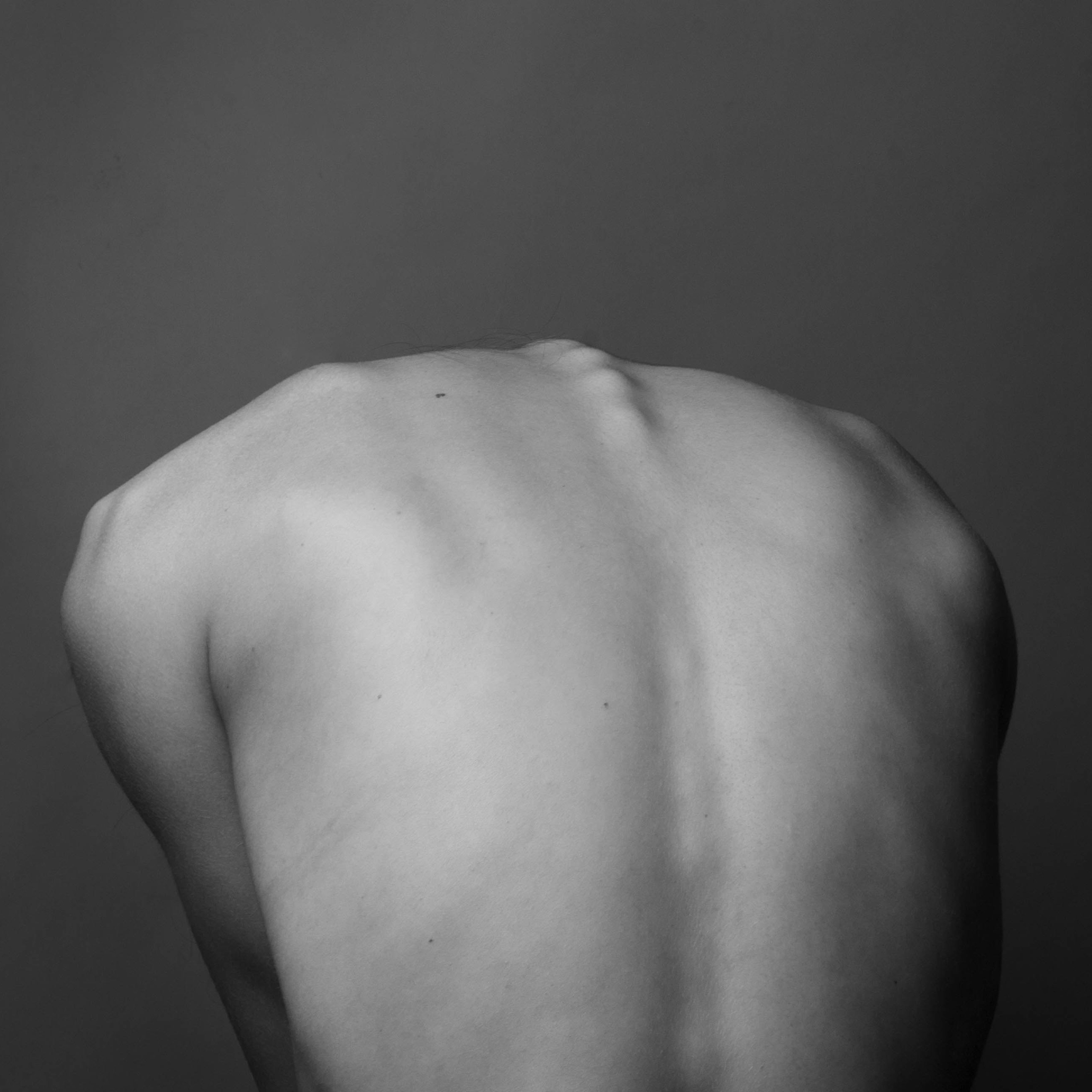 Cinco tratamientos para aliviar el dolor de espalda