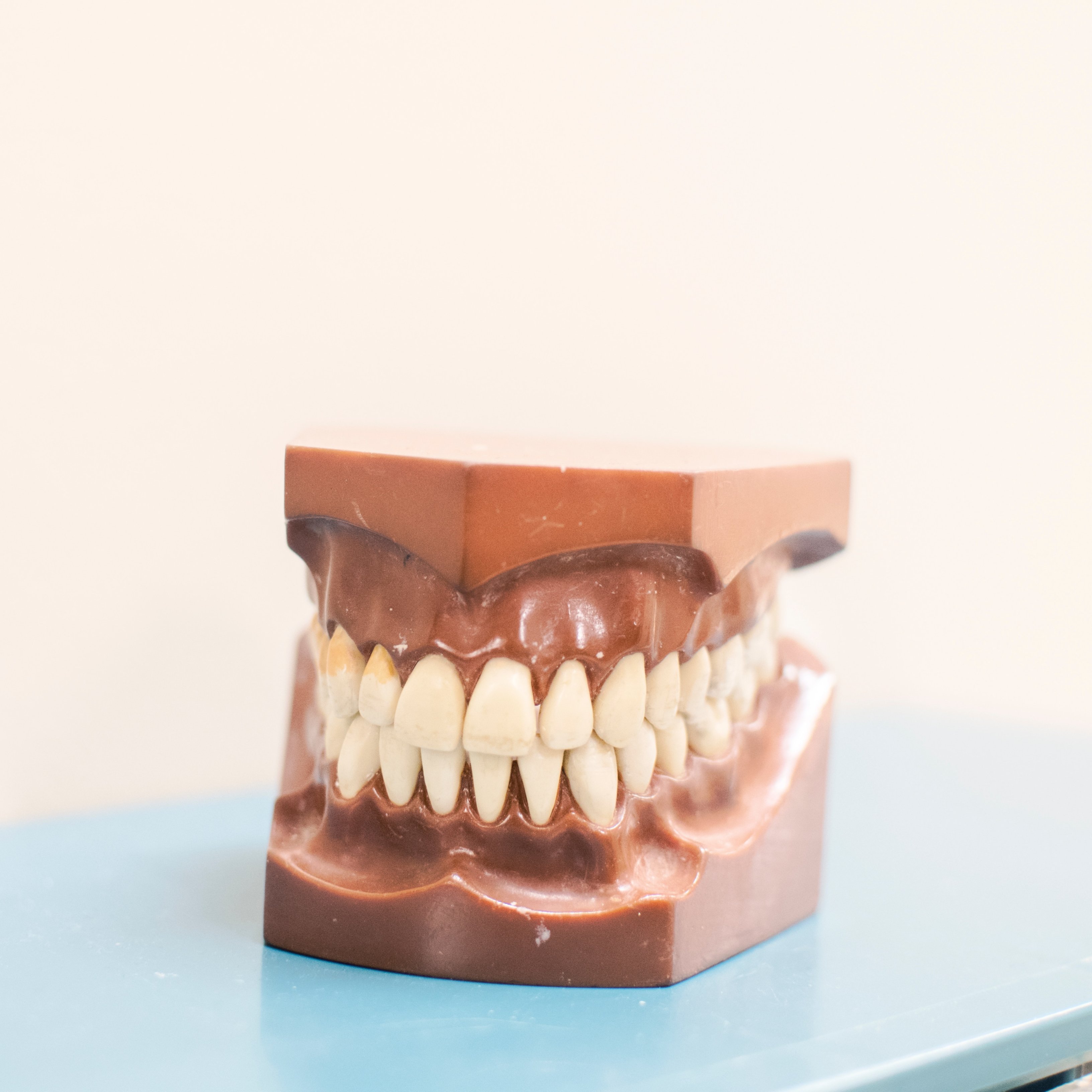 Así debes cuidar tus implantes y prótesis dentales