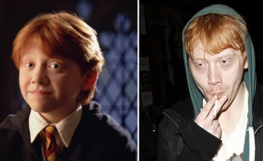 ron harry potter