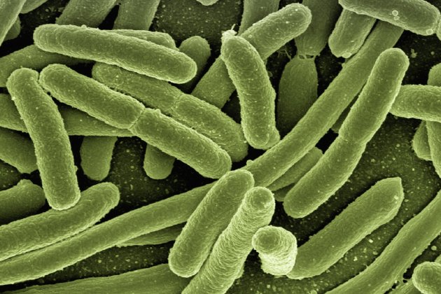 E. coli