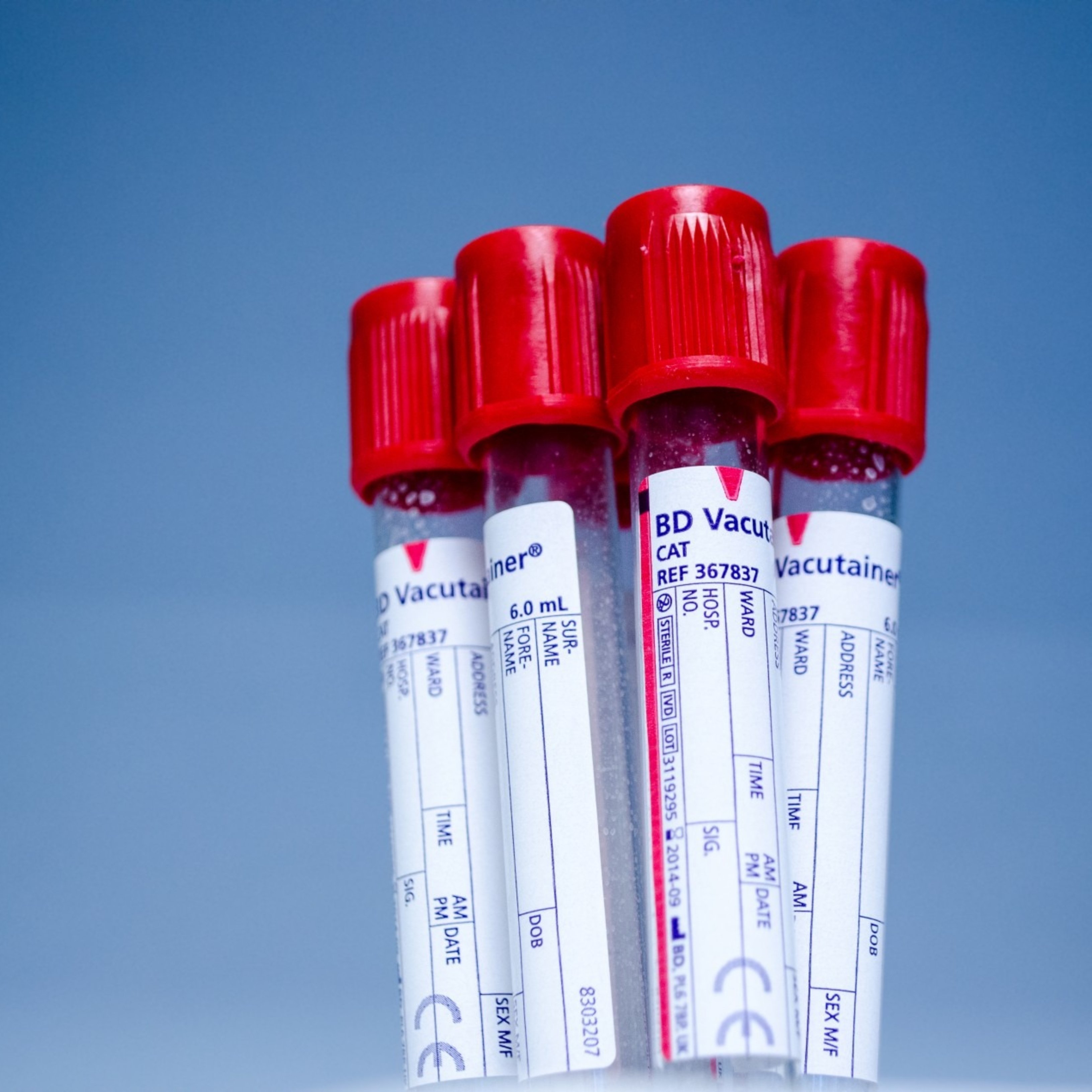 Estos marcadores de tu análisis de sangre podrían predecir una futura enfermedad